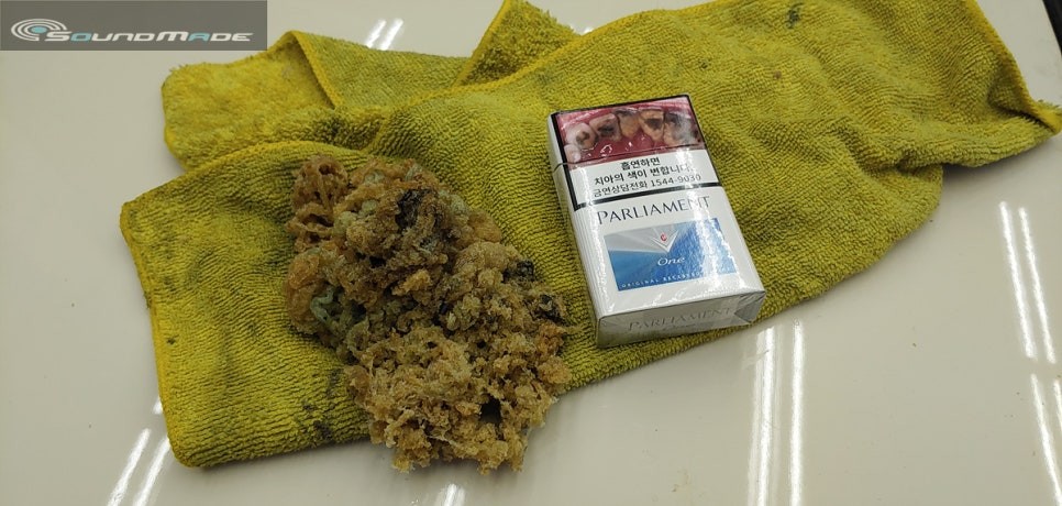 파사트 루프스킨제거 